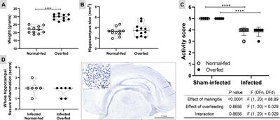 Neonatal overfeeding attenuates microgliosis and hippocampal damage in an infant rat model of pneumococcal meningitis